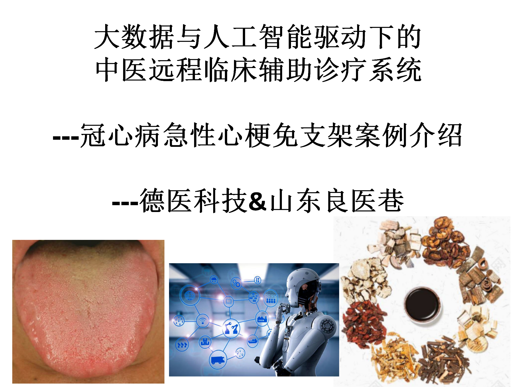 冠心病免支架案例