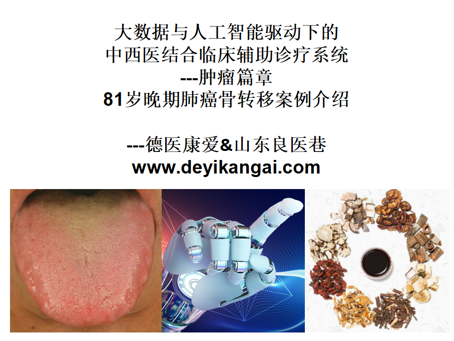 81岁肺癌晚期骨转移案例